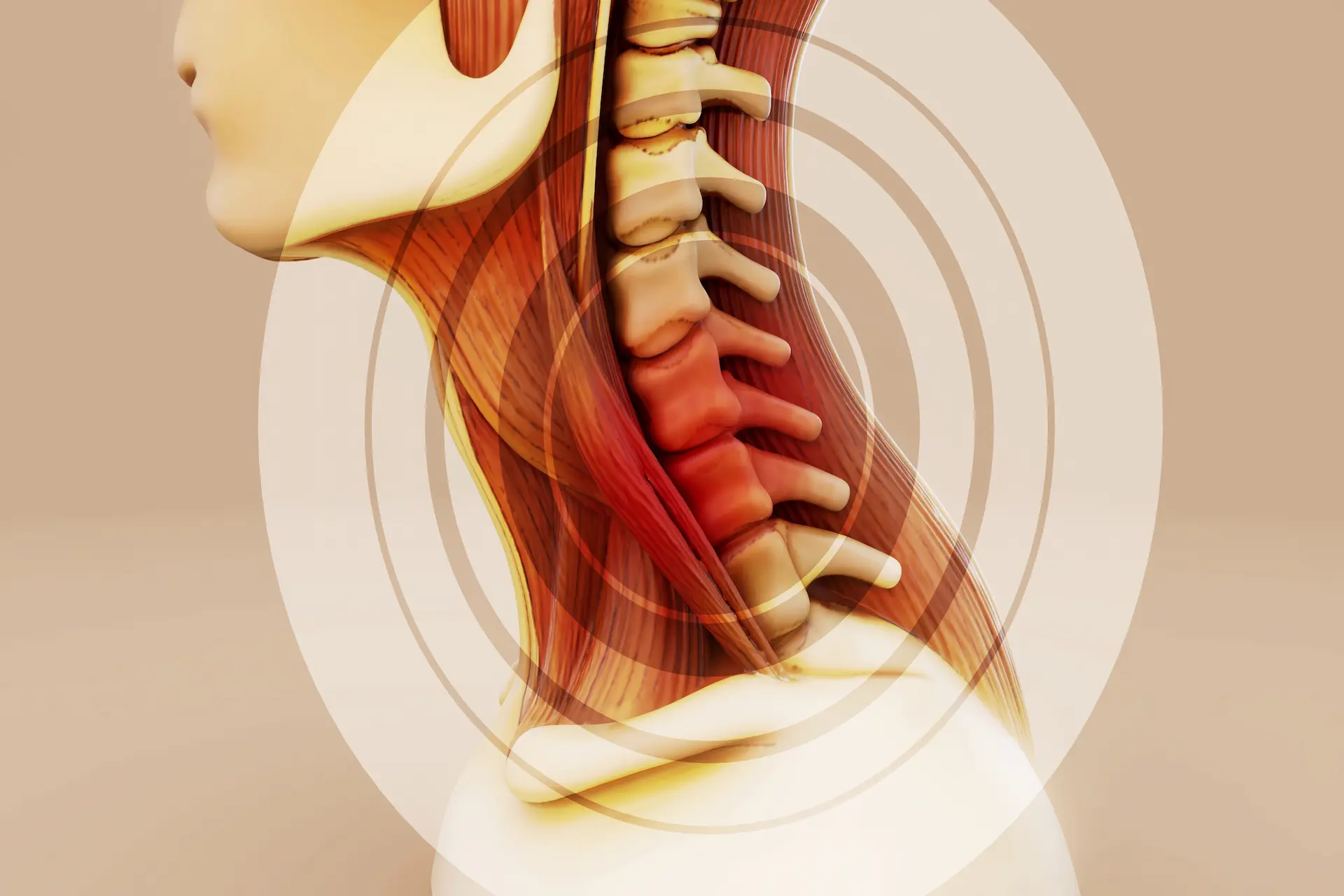 Cervical Discectomy